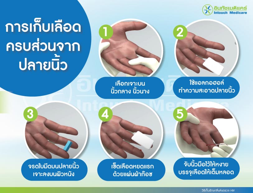 การเก็บเลือดส่วนจากปลายนิ้ว การเก็บเลือดส่วนจากปลายนิ้ว