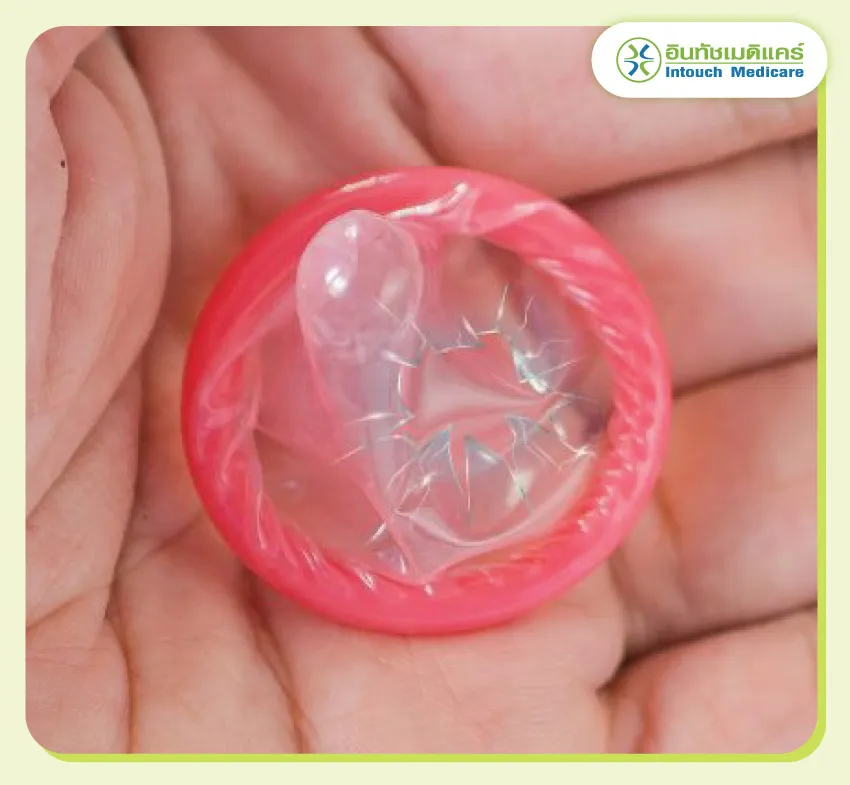 ถุงยางแตก ถุงยางรั่ว ถุงยางแตก ถุงยางรั่ว