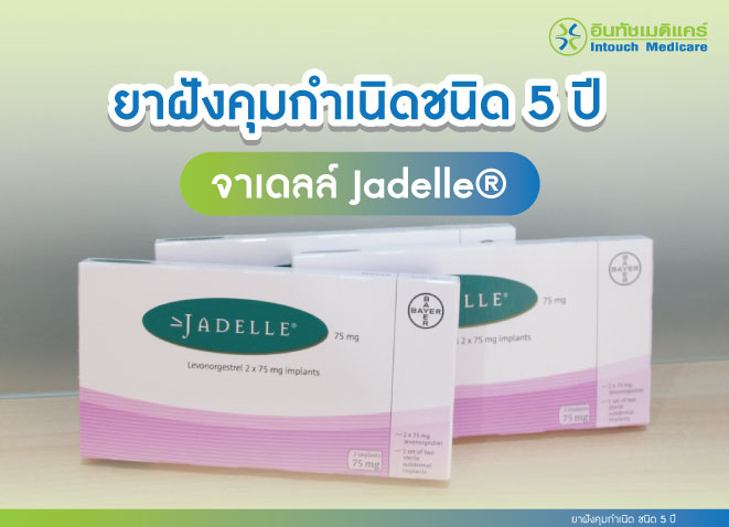 ยาฝังคุมกำเนิดชนิด 5 ปี ยาฝังคุมกำเนิดชนิด 5 ปี