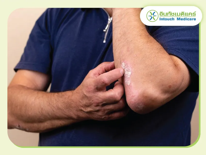 ผิวหนังอักเสบหรือไหม้จากสารพิษ ผิวหนังอักเสบหรือไหม้จากสารพิษ