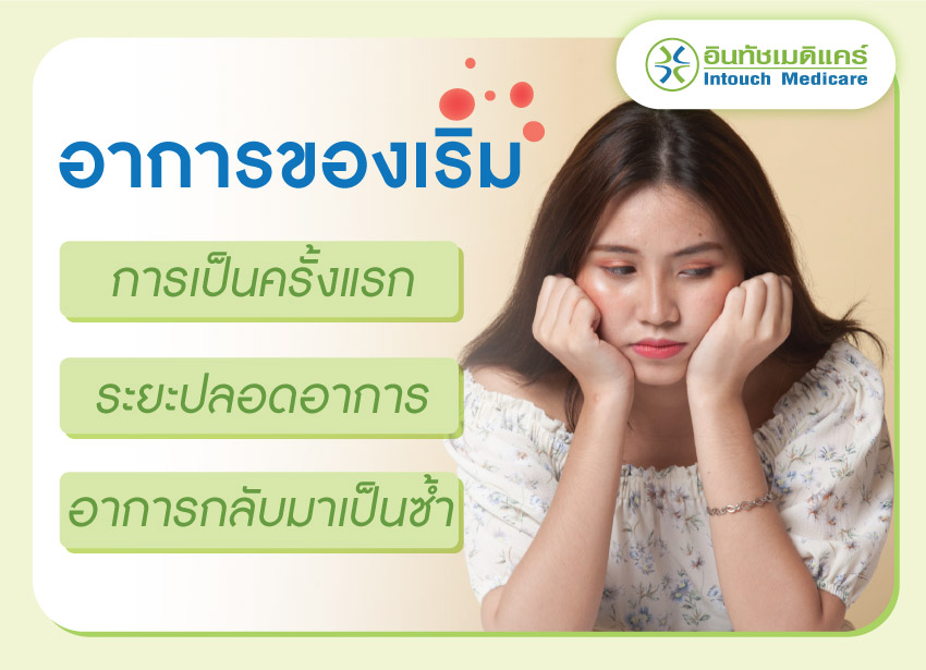 อาการของโรคเริมเป็นอย่างไร