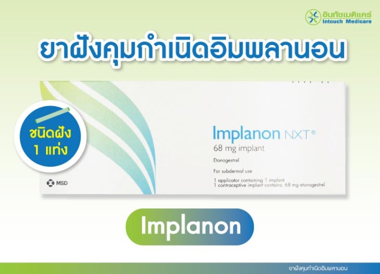 ยาฝังคุมกำเนิดอิมพลานอน ยาฝังคุมกำเนิดอิมพลานอน