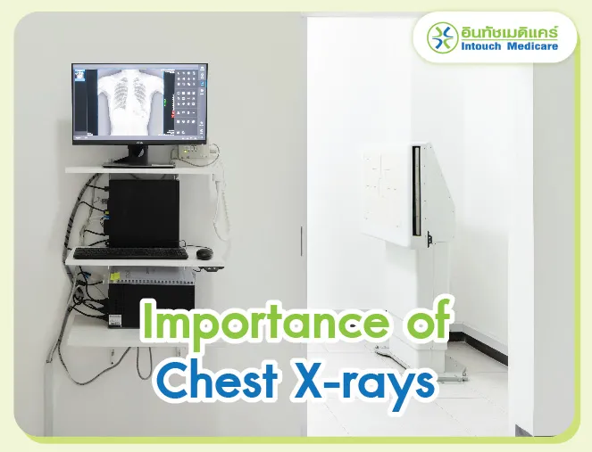 Importance of Chest X-rays Importance of Chest X-rays
