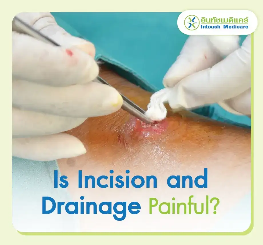 Is Incision and Drainage Painful? Is Incision and Drainage Painful?