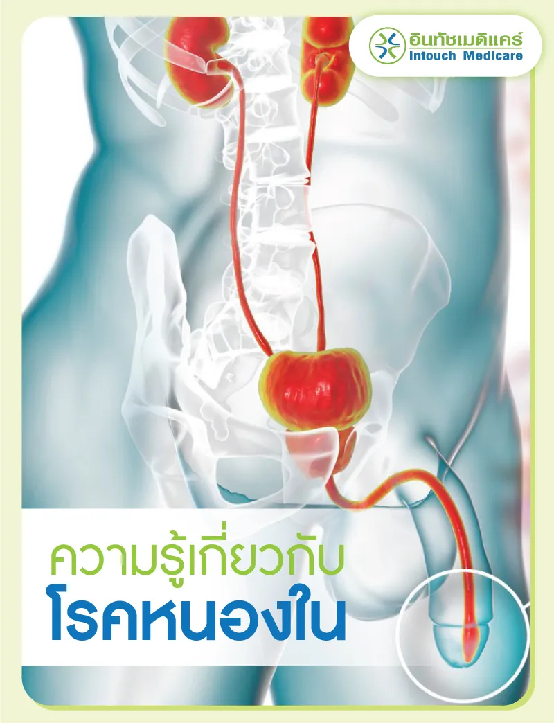 ความรู้เกี่ยวกับโรคหนองใน