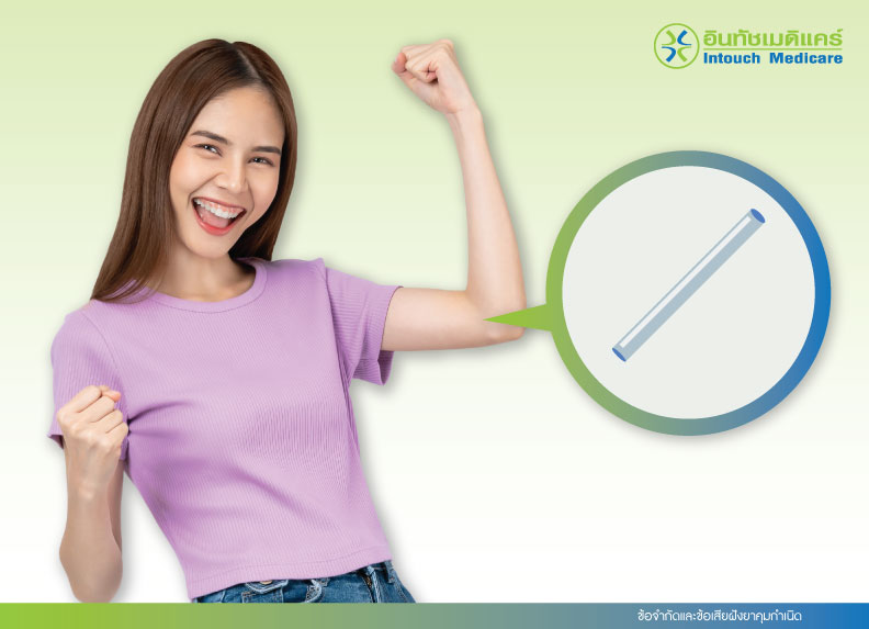 ข้อจำกัดและข้อเสียฝังยาคุมกำเนิด ข้อจำกัดและข้อเสียฝังยาคุมกำเนิด