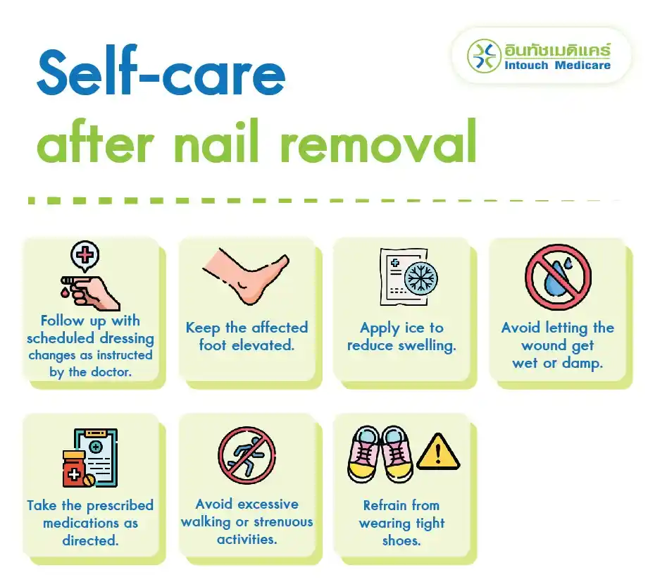 Self-care after nail removal. Self-care after nail removal.