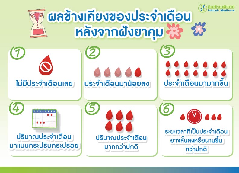 ผลข้างเคียงของประจำเดือนหลังจากฝังยาคุม