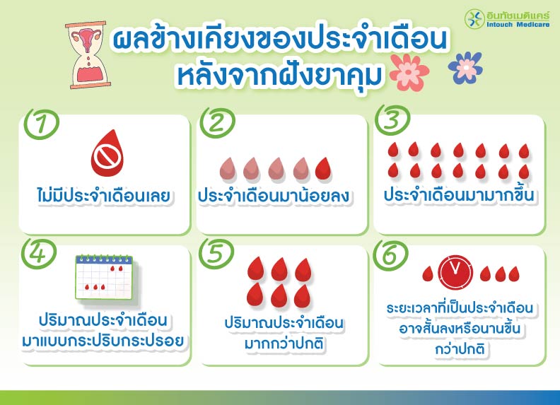 ผลข้างเคียงของประจำเดือนหลังจากฝังยาคุม ผลข้างเคียงของประจำเดือนหลังจากฝังยาคุม