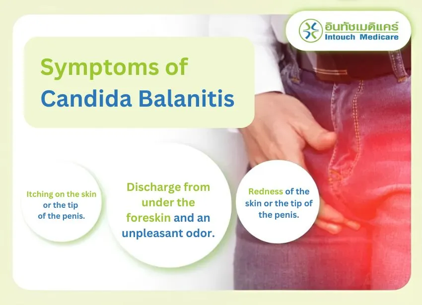 Candida Balanitis: Can it be treated? - intouchmedicare