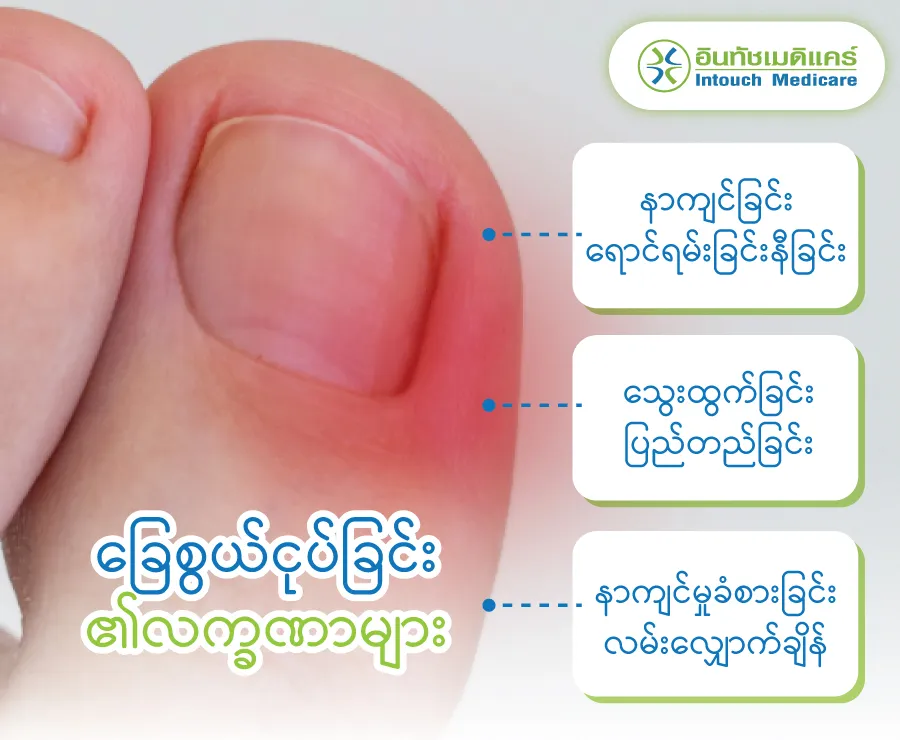 Symptoms of ingrown toenails Symptoms of ingrown toenails