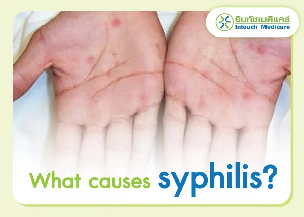 Syphilis Causes Syphilis Causes