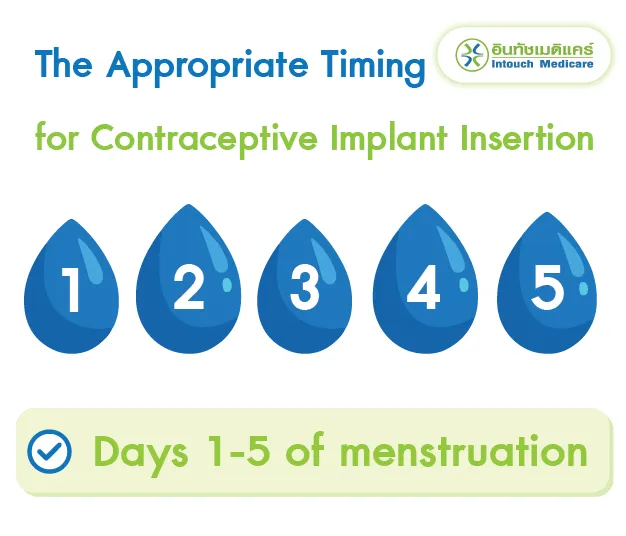 The Appropriate Timing for Contraceptive Implant Insertion The Appropriate Timing for Contraceptive Implant Insertion