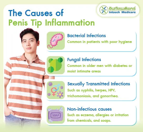The Causes of Penis Tip Inflammation. The Causes of Penis Tip Inflammation.