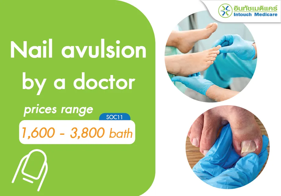 The price for nail avulsion (nail removal). The price for nail avulsion (nail removal).
