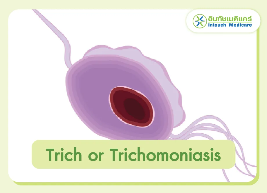 Trich or Trichomoniasis Trich or Trichomoniasis