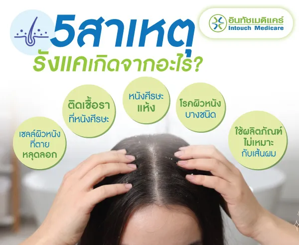 รังแค เกิดจาก อะไร