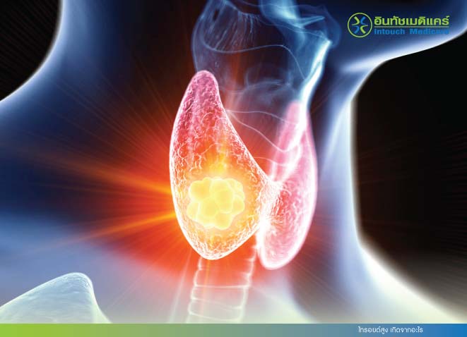 ไทรอยด์สูง เกิดจากอะไร ไทรอยด์สูง เกิดจากอะไร