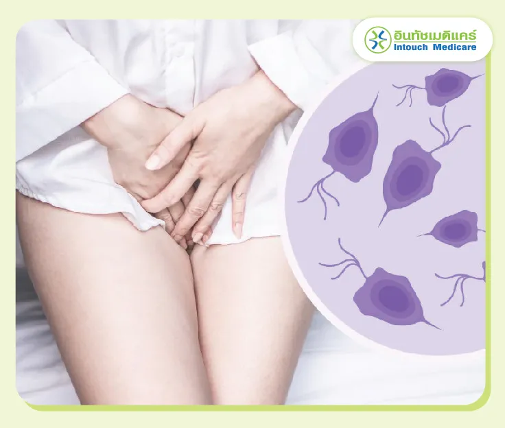 Trichomoniasis Trichomoniasis