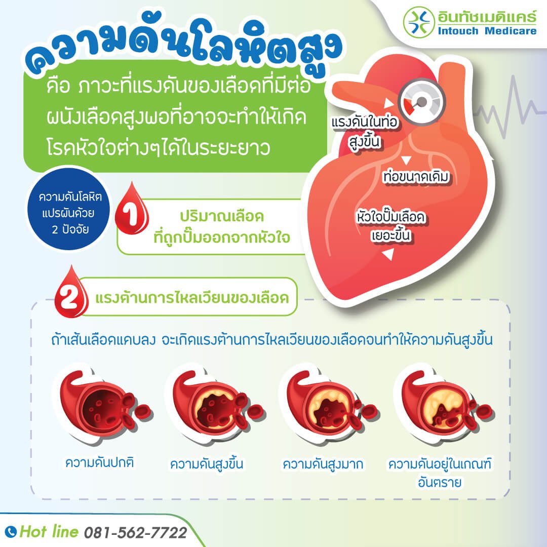 ความดันโลหิตสูง