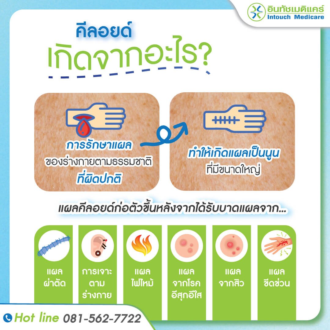 คีลอยด์ เกิดจากอะไร