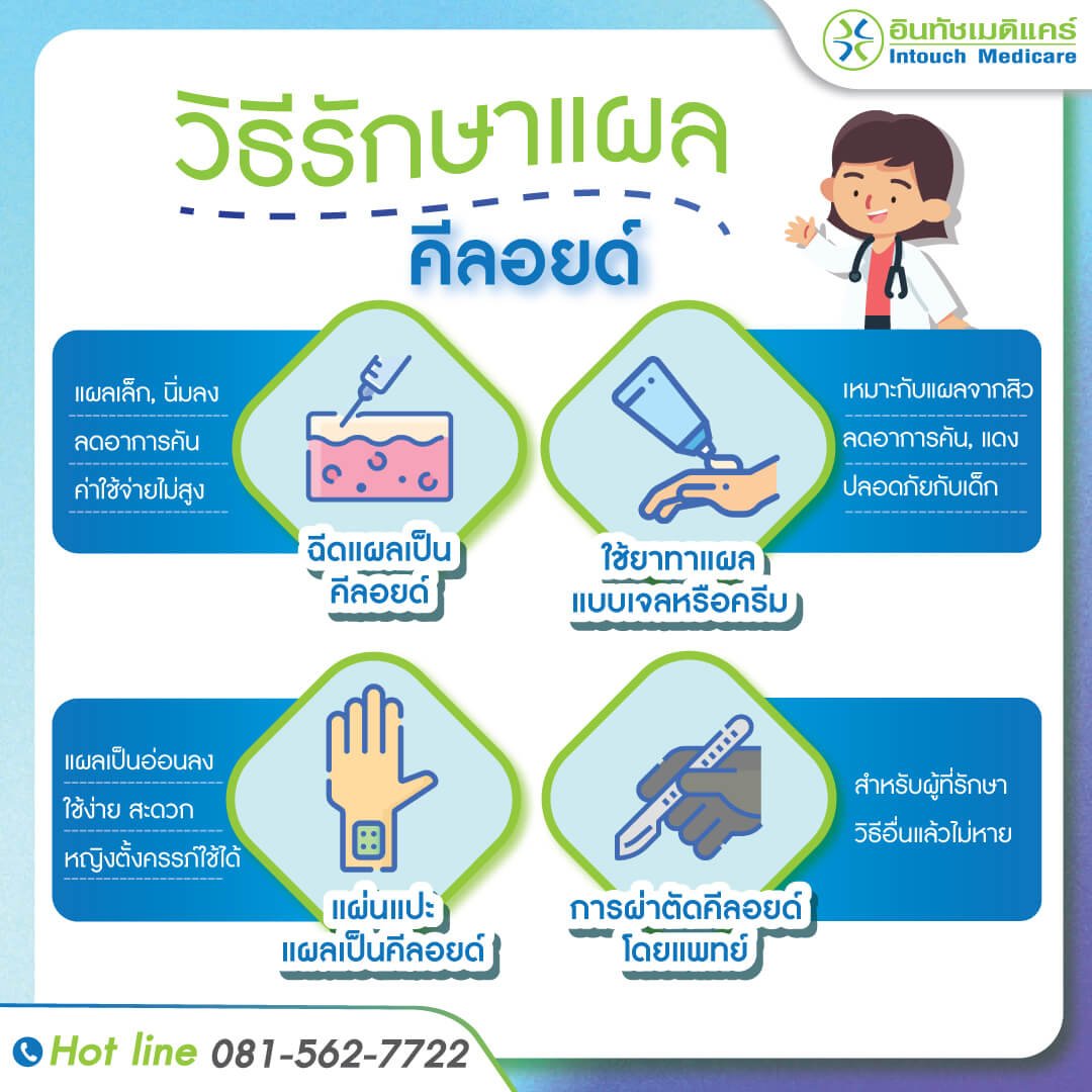 การรักษาคีลอยด์