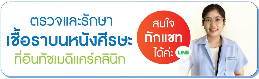 สนใจรักษาเชื้อราบนหนังศีรษะ สนใจรักษาเชื้อราบนหนังศีรษะ