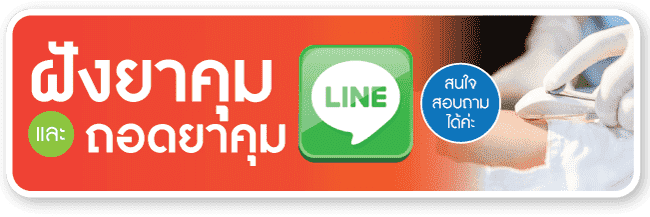 ฝังยาคุมและถอดยาคุม line สอบถาม