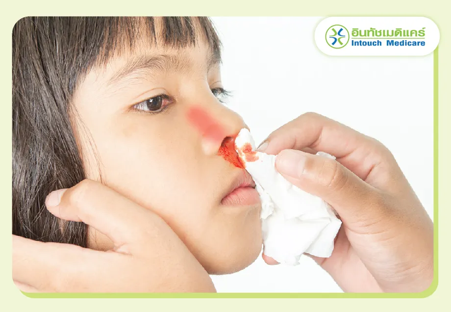 เลือดกำเดาไหล เลือดกำเดาไหล