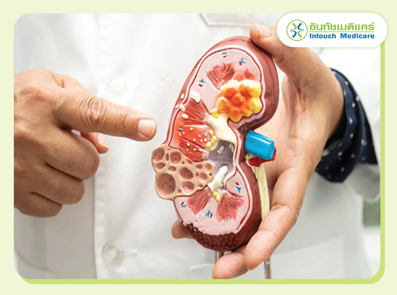 Kidney dialysis patients Kidney dialysis patients