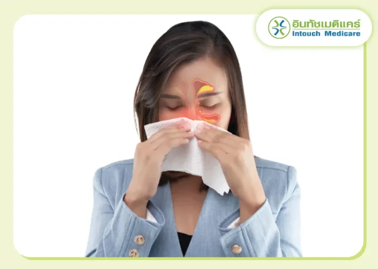 ไซนัสอักเสบ ไซนัสอักเสบ