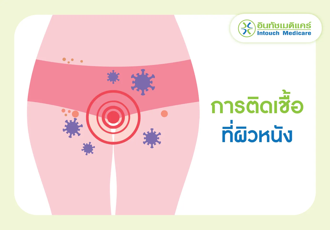 ติดเชื้อที่ผิวหนัง ติดเชื้อที่ผิวหนัง