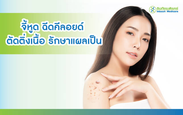 จี้หูด ฉีดคีลอยด์ ตัดติ่งเนื้อ จี้หูด ฉีดคีลอยด์ ตัดติ่งเนื้อ