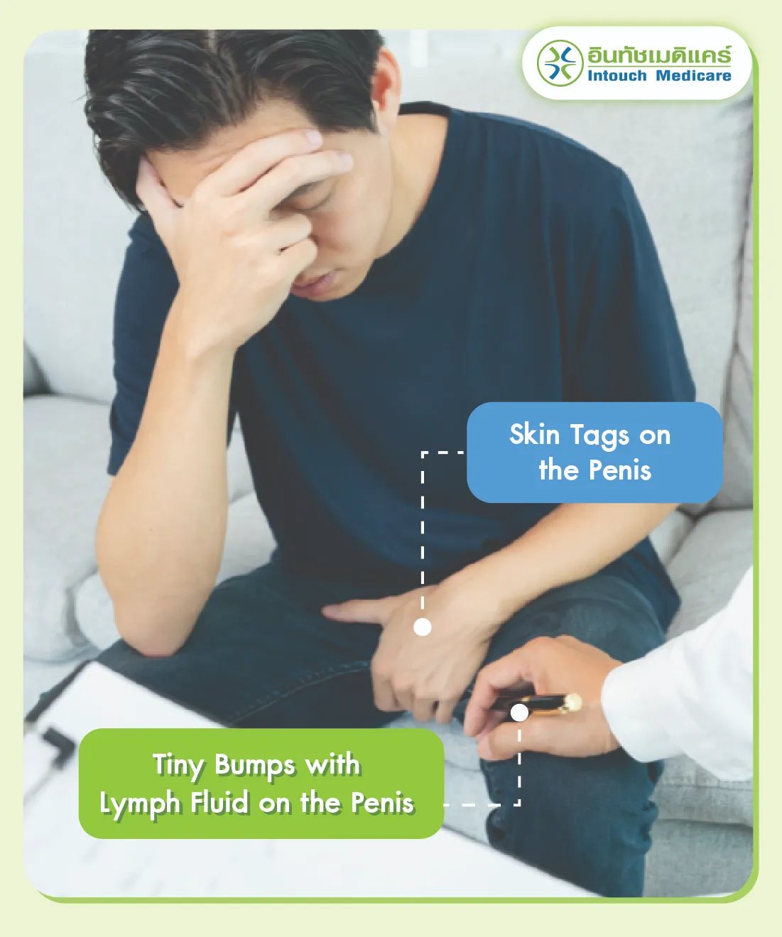 Skin Tags on the Penis Skin Tags on the Penis