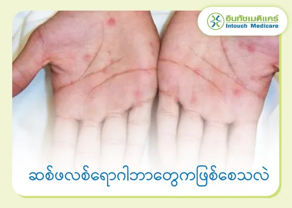 ဆစ်ဖလစ်ရောဂါဘာတွေကဖြစ်စေသလဲ ဆစ်ဖလစ်ရောဂါဘာတွေကဖြစ်စေသလဲ