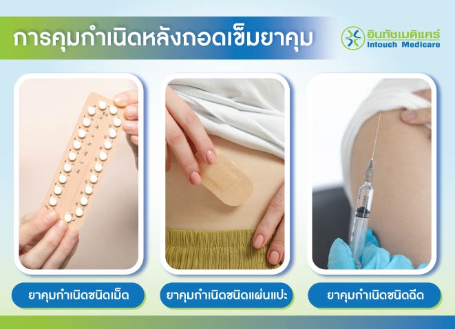 การคุมกำเนิดหลังถอดเข็มยาคุม การคุมกำเนิดหลังถอดเข็มยาคุม