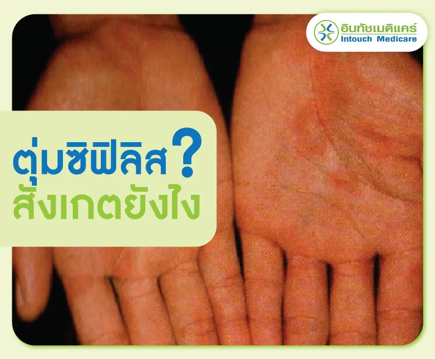 ตุ่มซิฟิลิสสังเกตยังไง ตุ่มซิฟิลิสสังเกตยังไง