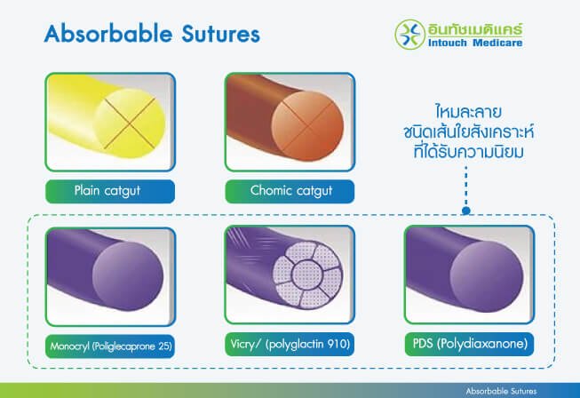 ไหมเย็บแผล ไหมละลาย ไหมเย็บแผล ไหมละลาย