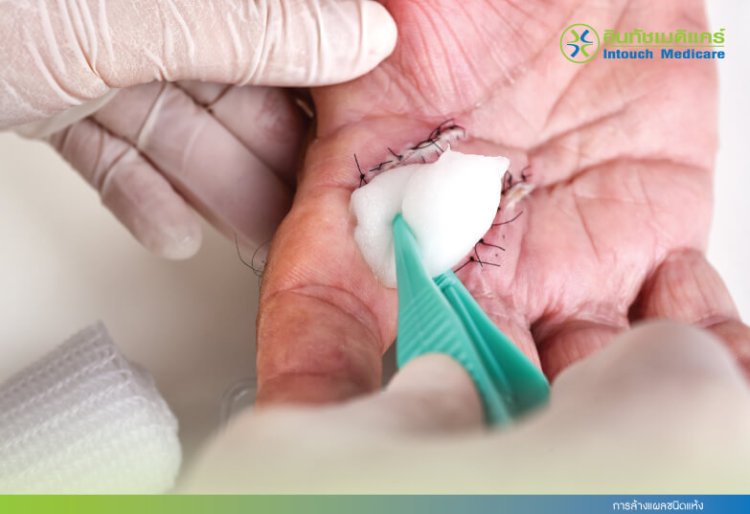 Dry wound cleaning Dry wound cleaning