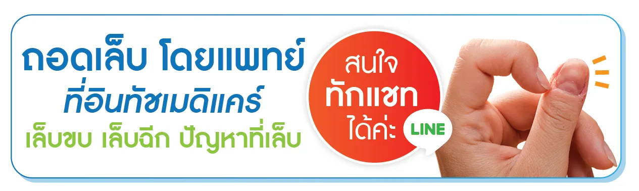 ถอดเล็บโดยแพทย์ คลิกเลย ถอดเล็บโดยแพทย์ คลิกเลย