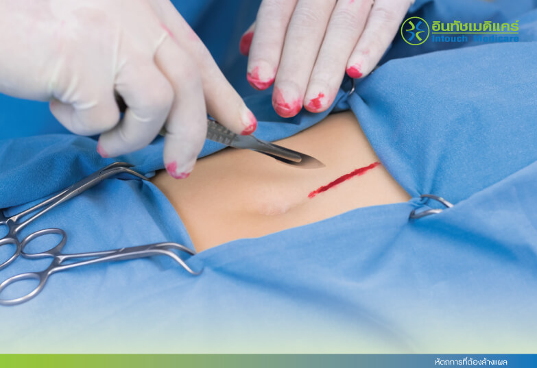 Procedures that require wound cleaning Procedures that require wound cleaning