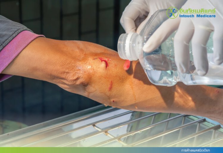 Wet wound cleaning Wet wound cleaning